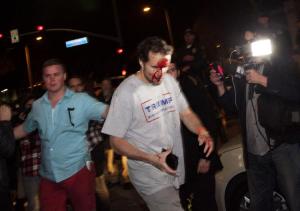 bloodied-trump-supporter